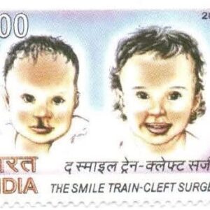 India 2011 The Smile Train - Cleft Surgery Postage Stamp Mint Unhinged